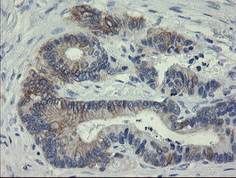 SLA2 Antibody in Immunohistochemistry (Paraffin) (IHC (P))