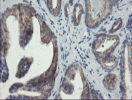 SLA2 Antibody in Immunohistochemistry (Paraffin) (IHC (P))