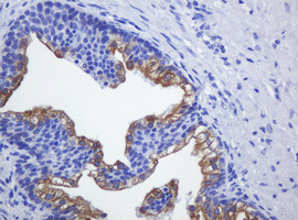 SLA2 Antibody in Immunohistochemistry (Paraffin) (IHC (P))
