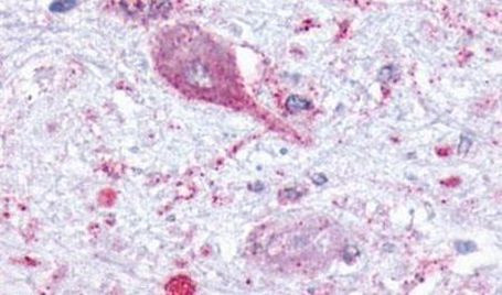 MCHR1 Antibody in Immunohistochemistry (Paraffin) (IHC (P))