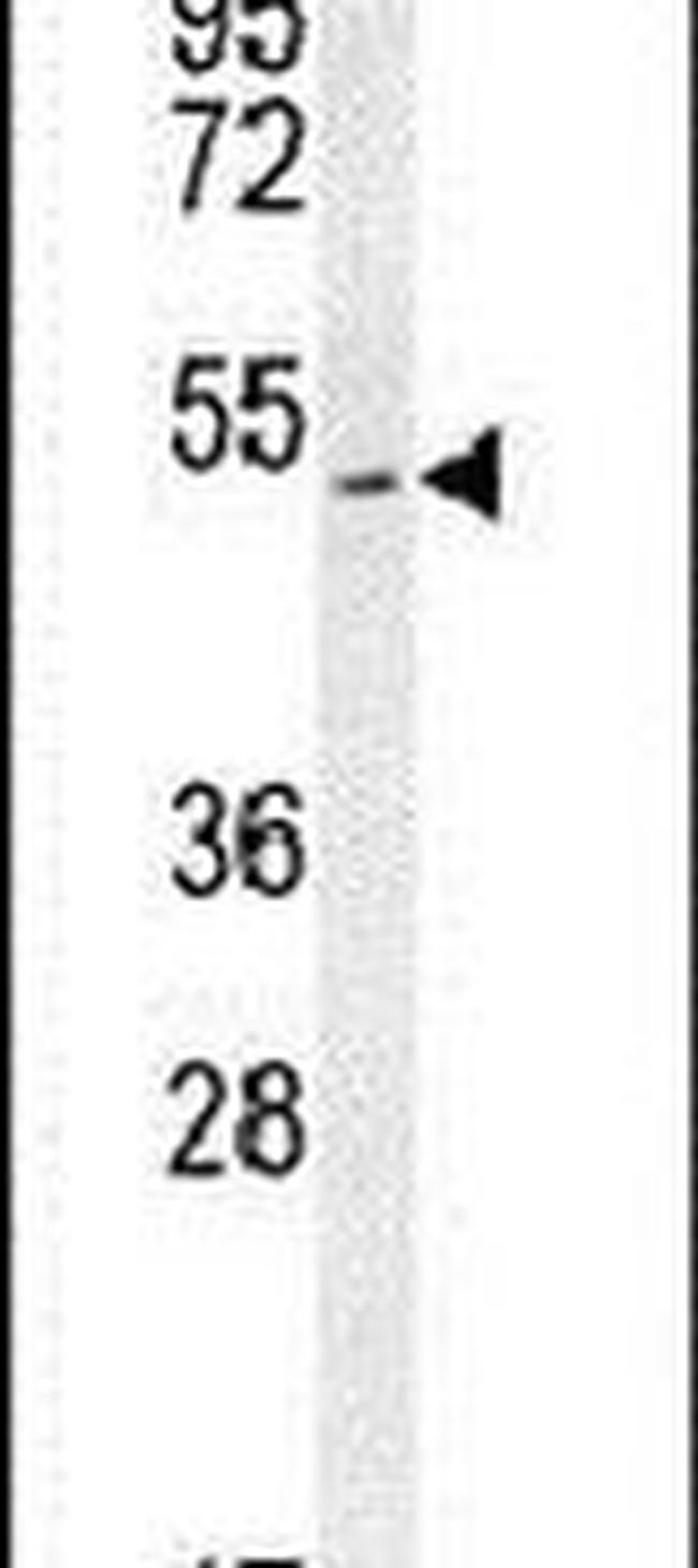 SLC10A4 Antibody in Western Blot (WB)