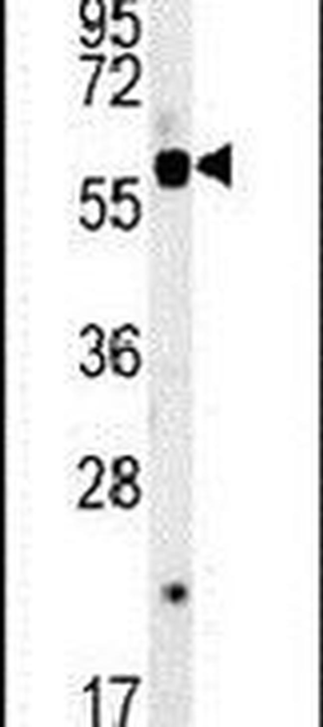 SLC16A9 Antibody in Western Blot (WB)