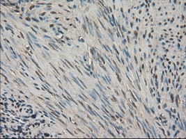 SLC18A2 Antibody in Immunohistochemistry (Paraffin) (IHC (P))
