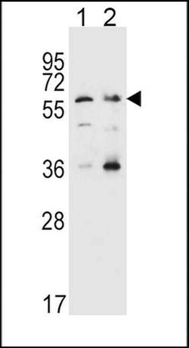 SLC22A4 Antibody in Western Blot (WB)