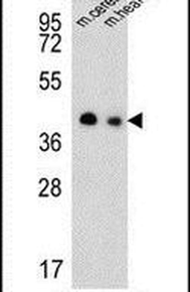 SLC25A19 Antibody in Western Blot (WB)
