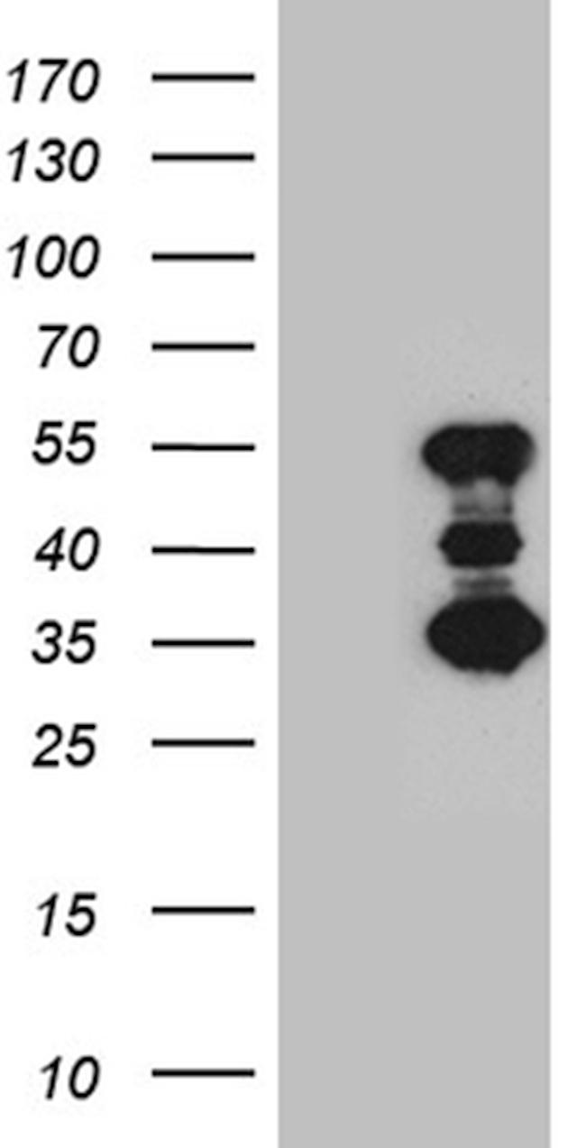 SLC2A4RG Antibody in Western Blot (WB)