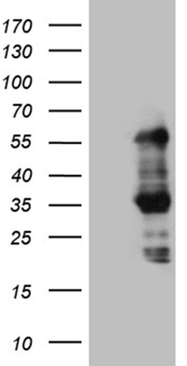 SLC2A4RG Antibody in Western Blot (WB)