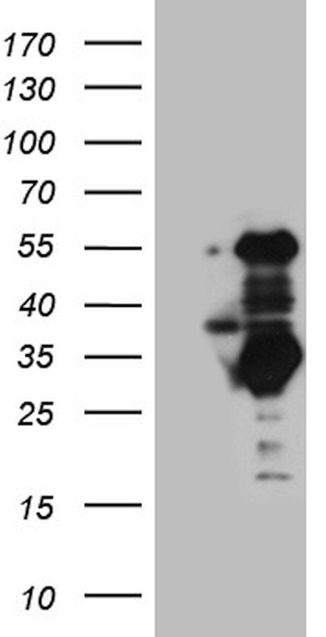 SLC2A4RG Antibody in Western Blot (WB)