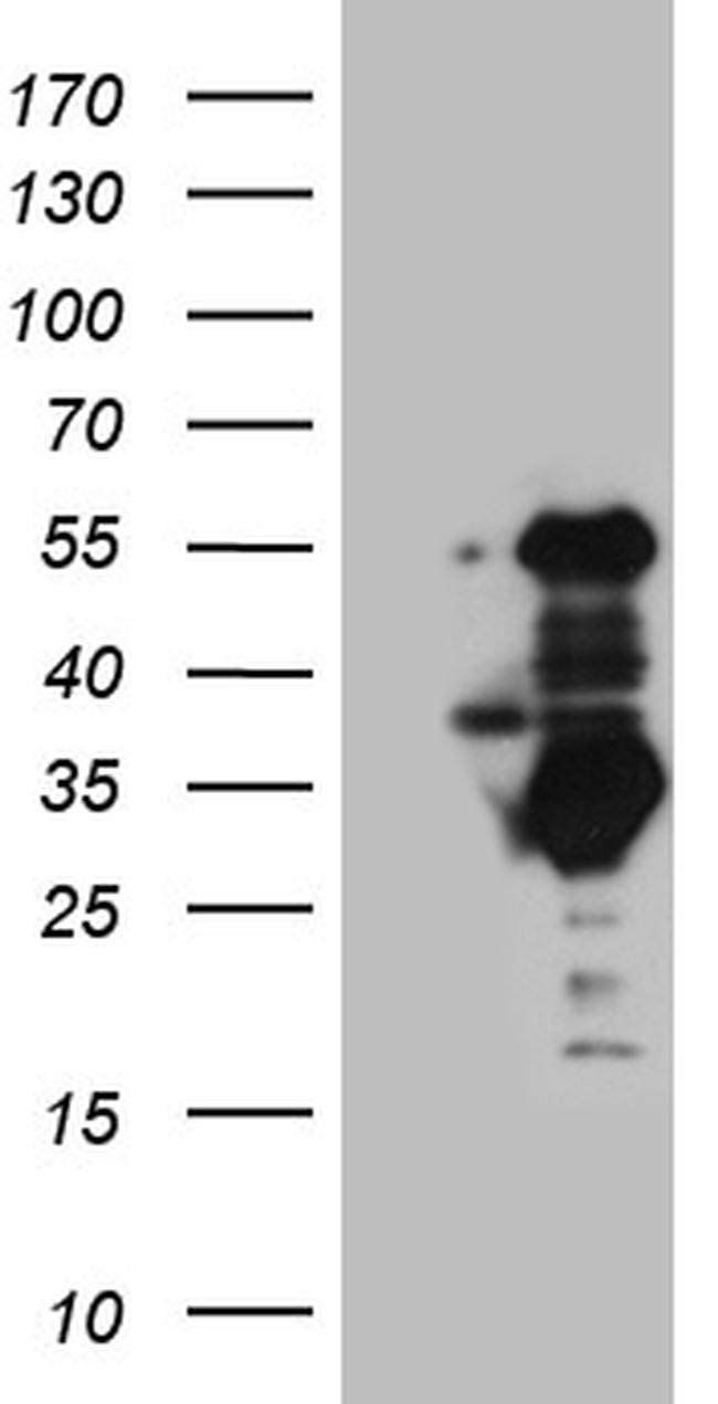 SLC2A4RG Antibody in Western Blot (WB)