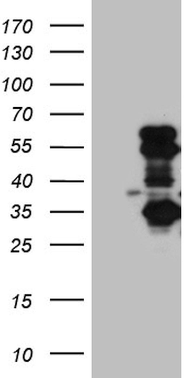 SLC2A4RG Antibody in Western Blot (WB)