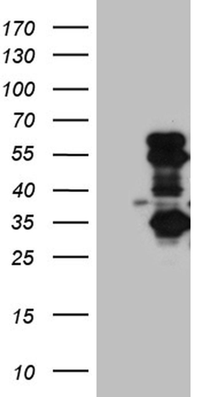 SLC2A4RG Antibody in Western Blot (WB)