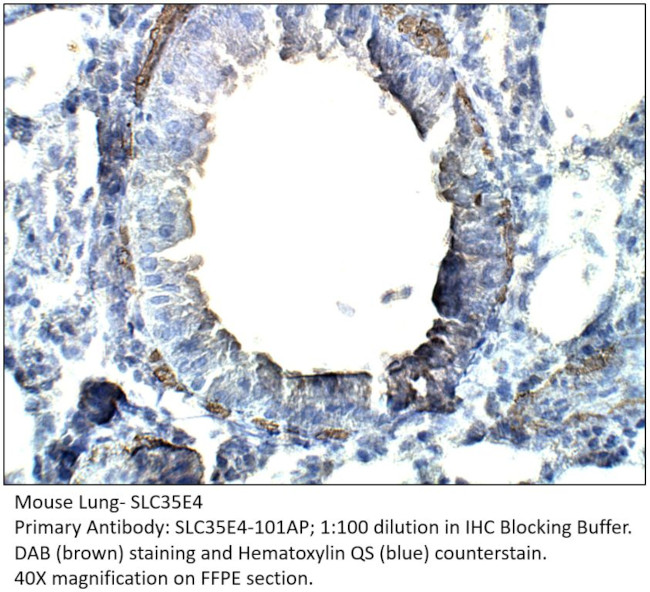 Solute carrier family 35 member E4 Antibody in Immunohistochemistry (IHC)