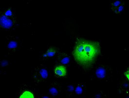 SLC7A8 Antibody in Immunocytochemistry (ICC/IF)