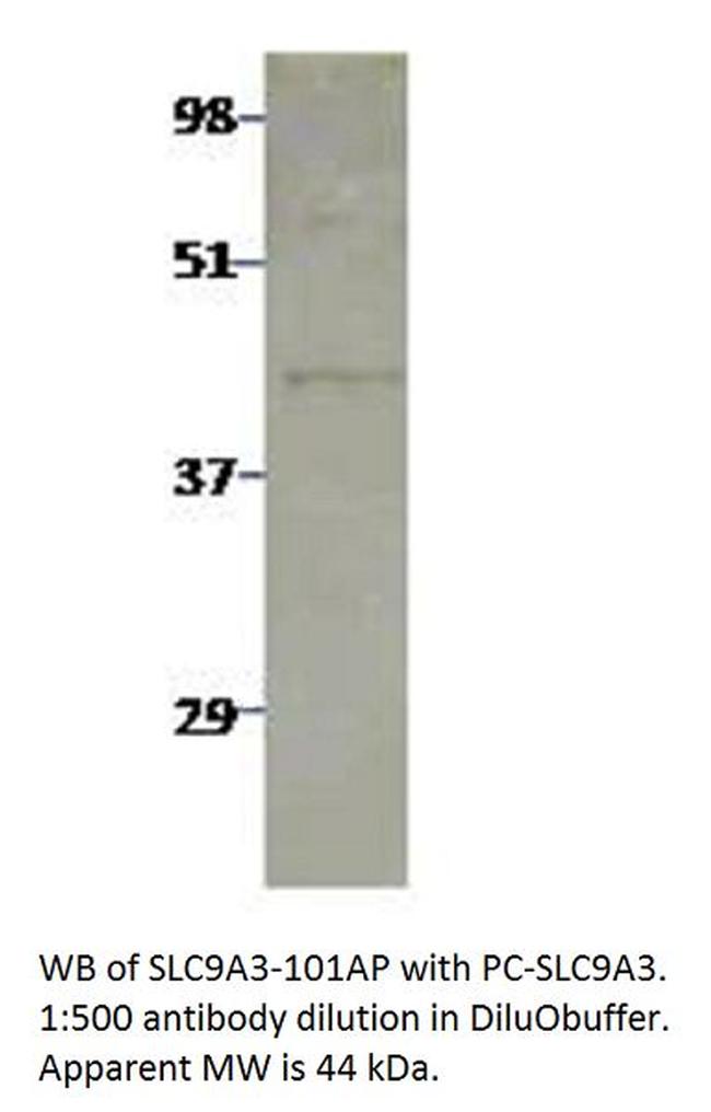 Sodium/Hydrogen Exchanger 3 Antibody in Western Blot (WB)