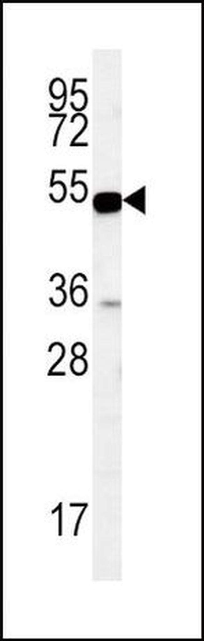 EBP50 Antibody in Western Blot (WB)