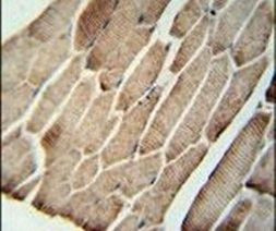 SLC9A9 Antibody in Immunohistochemistry (IHC)