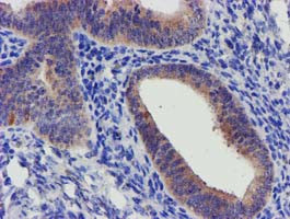 SLFNL1 Antibody in Immunohistochemistry (Paraffin) (IHC (P))