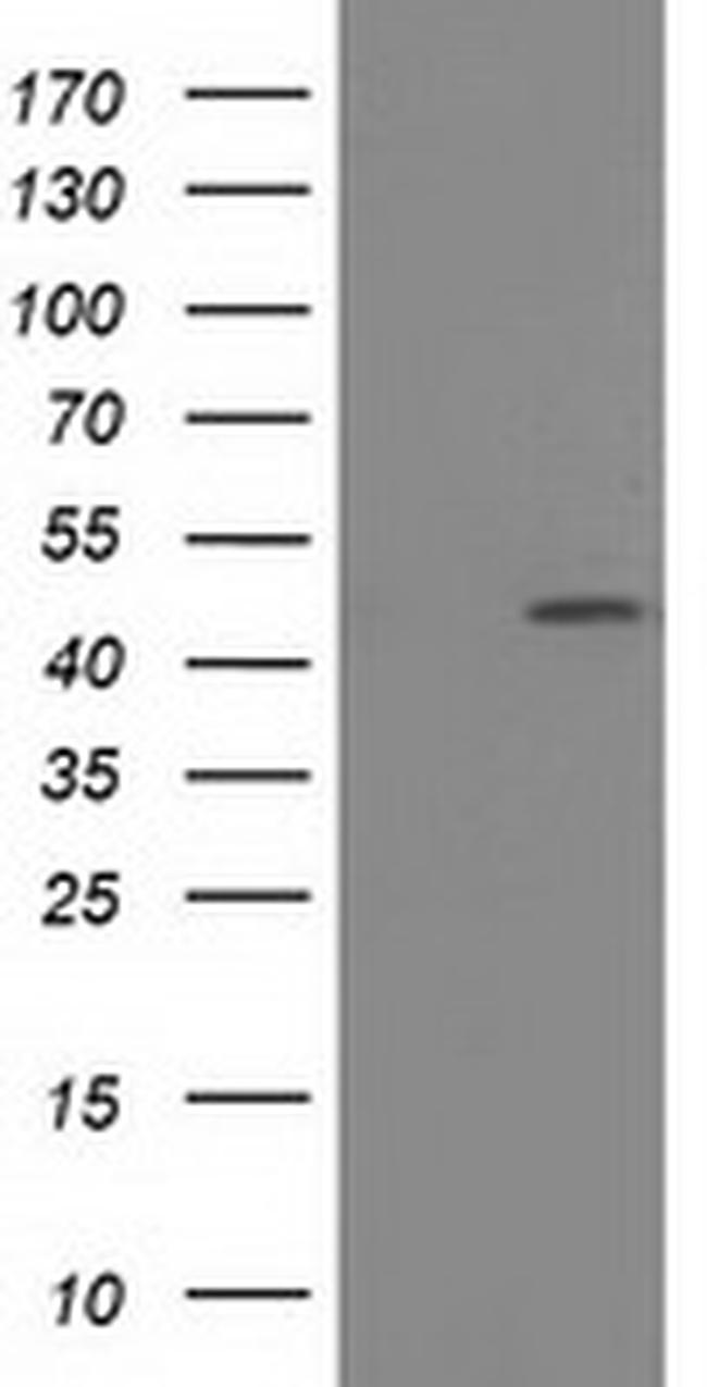 SLFNL1 Antibody in Western Blot (WB)