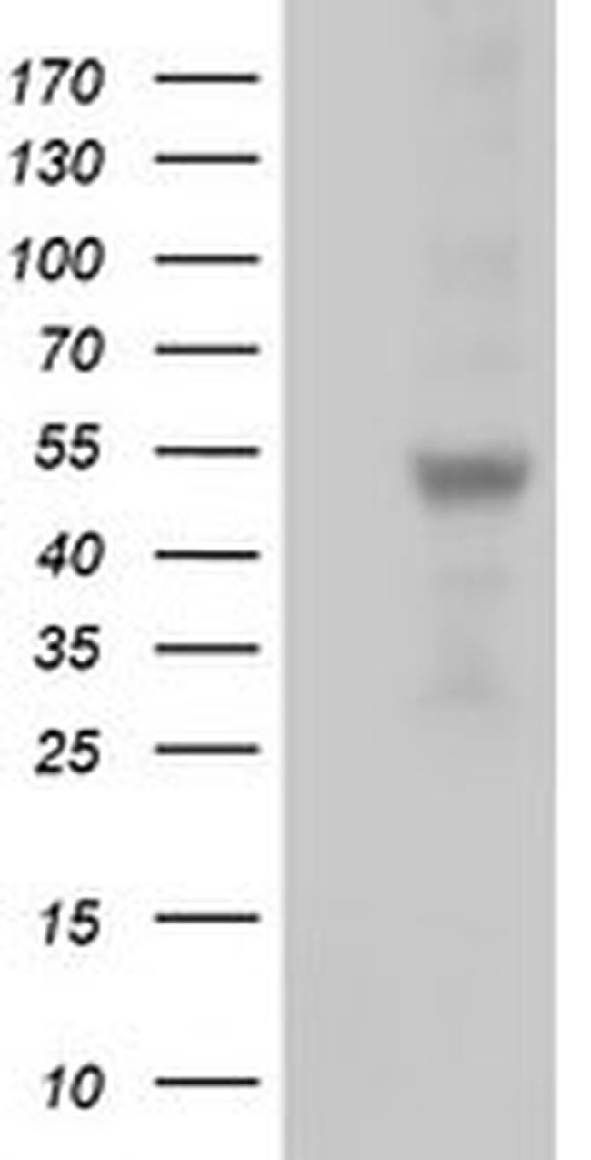 SLFNL1 Antibody in Western Blot (WB)