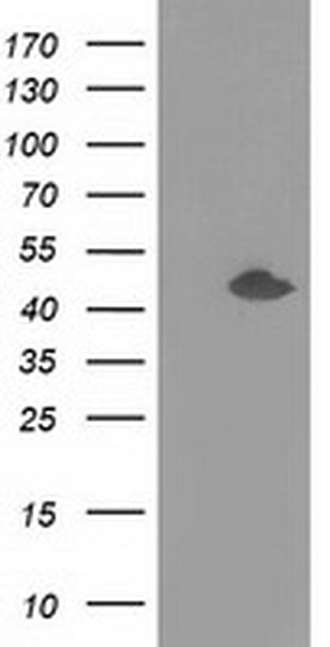 SLFNL1 Antibody in Western Blot (WB)