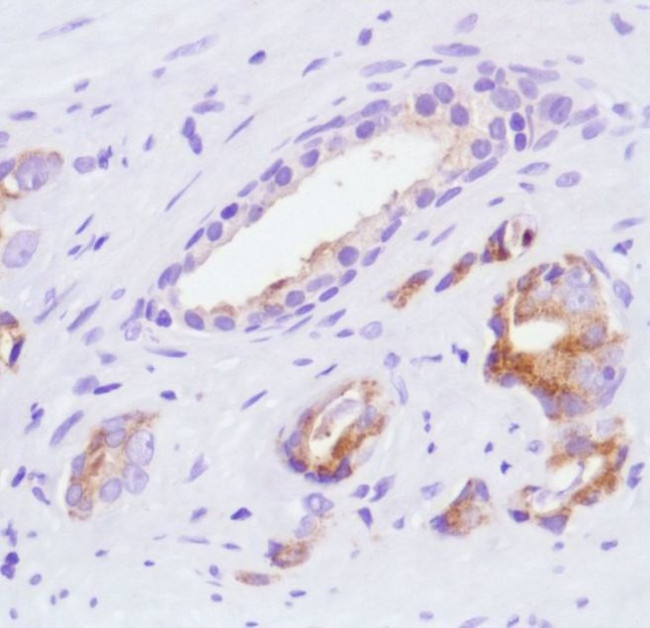SLIT2 Antibody in Immunohistochemistry (IHC)