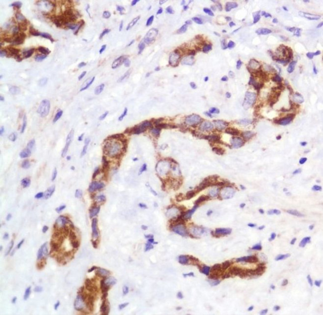 SLIT2 Antibody in Immunohistochemistry (IHC)