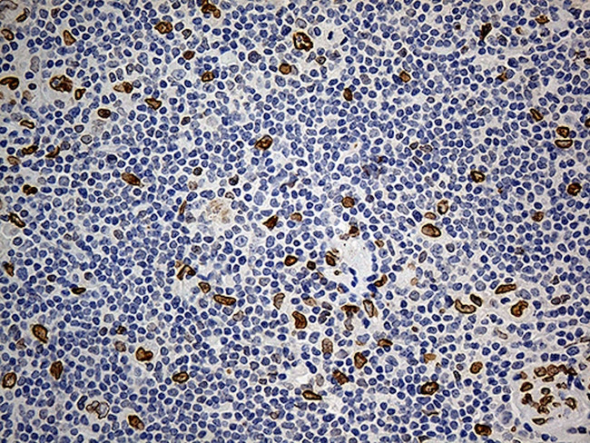 SLU7 Antibody in Immunohistochemistry (Paraffin) (IHC (P))