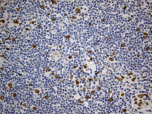 SLU7 Antibody in Immunohistochemistry (Paraffin) (IHC (P))
