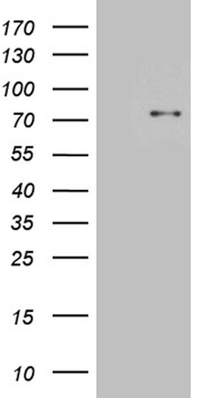 SLU7 Antibody in Western Blot (WB)