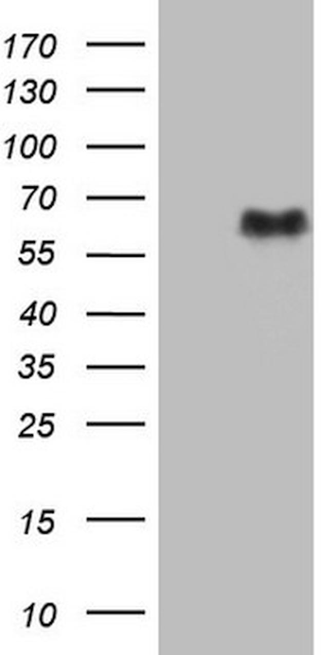 SMAD1 Antibody in Western Blot (WB)
