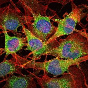 SMAD2 Antibody in Immunocytochemistry (ICC/IF)