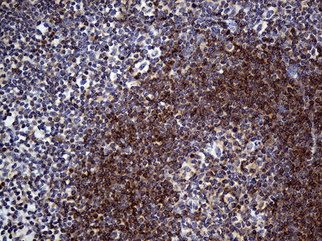 SMAP2 Antibody in Immunohistochemistry (Paraffin) (IHC (P))