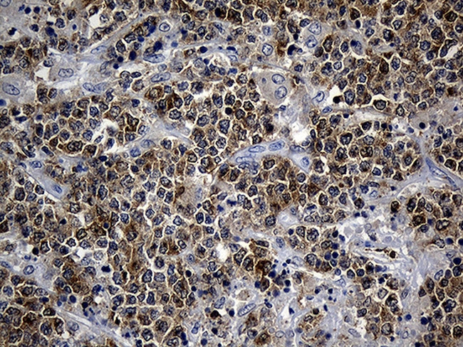 SMAP2 Antibody in Immunohistochemistry (Paraffin) (IHC (P))