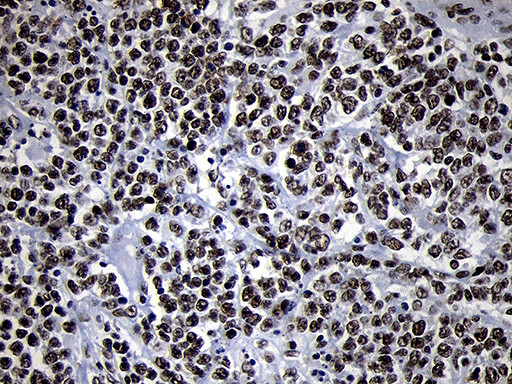 SMC1A Antibody in Immunohistochemistry (Paraffin) (IHC (P))