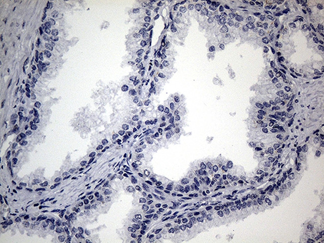 SMC1A Antibody in Immunohistochemistry (Paraffin) (IHC (P))