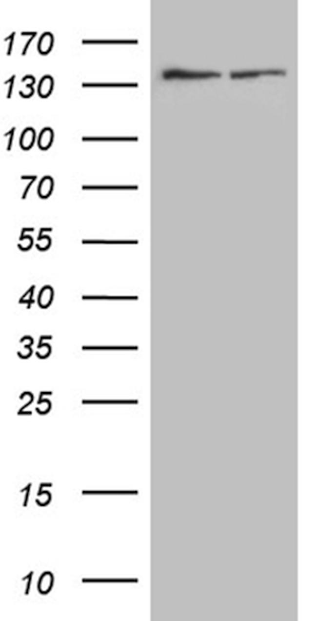 SMC1A Antibody in Western Blot (WB)