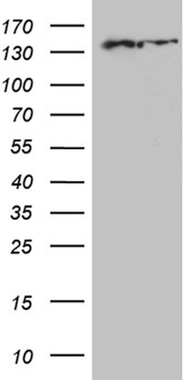 SMC1A Antibody in Western Blot (WB)