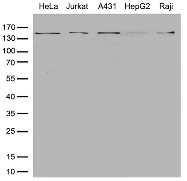 SMC1A Antibody in Western Blot (WB)