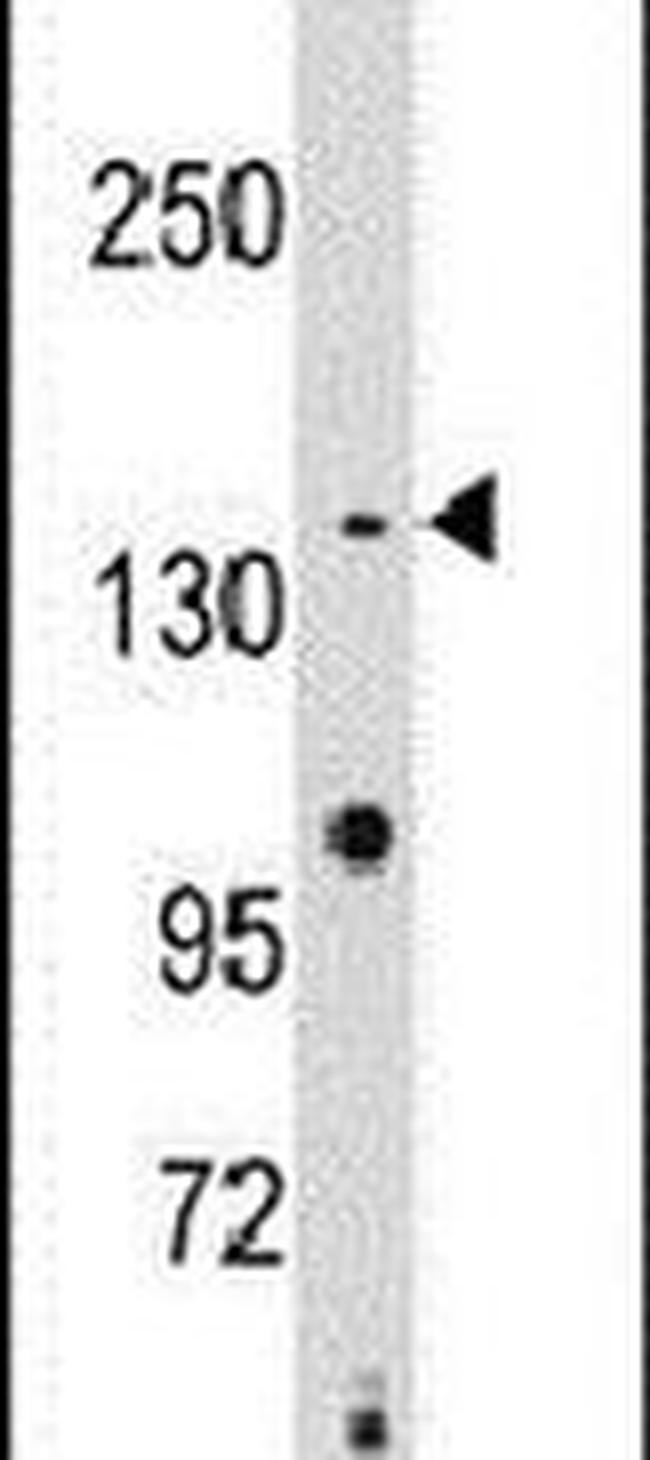 SMC2 Antibody in Western Blot (WB)