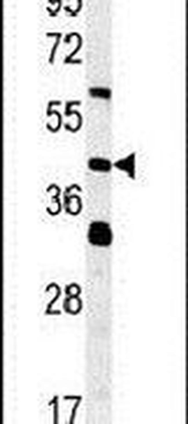 SMCR7L Antibody in Western Blot (WB)