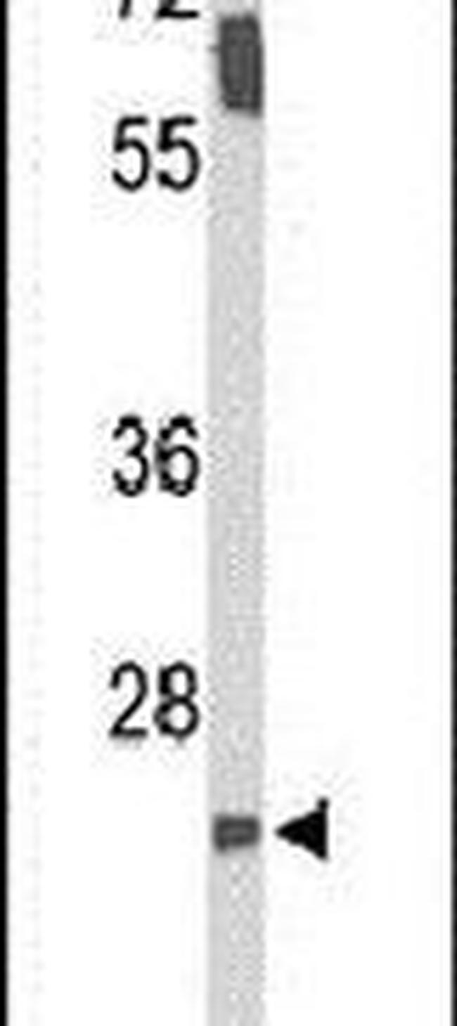 SMNDC1 Antibody in Western Blot (WB)