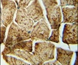 SMPD4 Antibody in Immunohistochemistry (IHC)