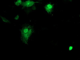 SMS Antibody in Immunocytochemistry (ICC/IF)