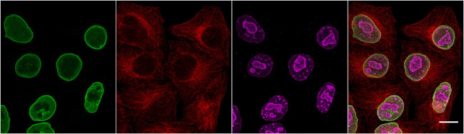 Mouse IgG3 VHH Secondary Antibody in Immunocytochemistry (ICC/IF)