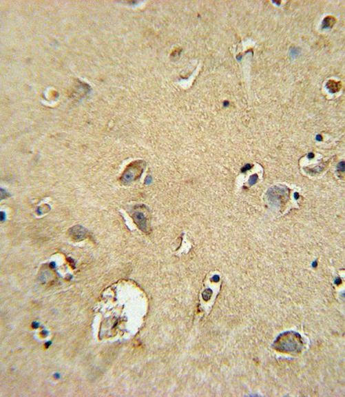 SMS Antibody in Immunohistochemistry (IHC)