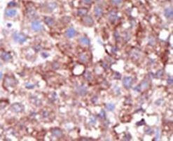 SMURF1 Antibody in Immunohistochemistry (IHC)
