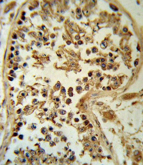 SMYD3 Antibody in Immunohistochemistry (IHC)