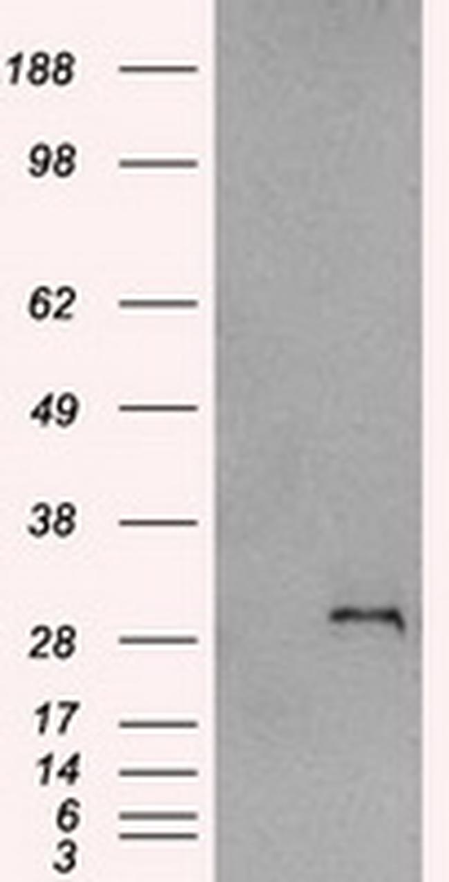 SNAI1 Antibody in Western Blot (WB)