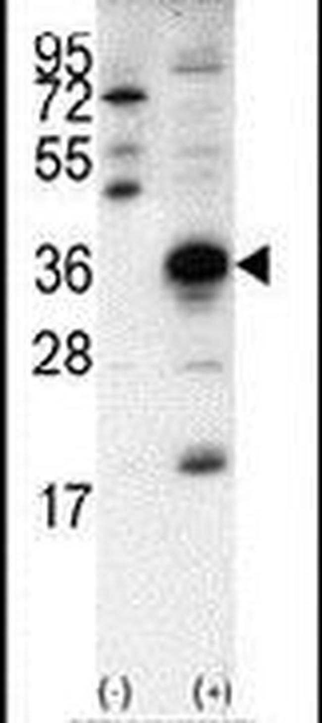 SNAIL Antibody in Western Blot (WB)