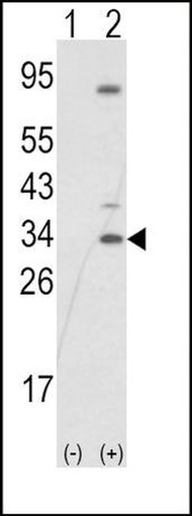 SNAIL Antibody in Western Blot (WB)